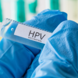 Infecția cu HPV: cauze, simptome și prevenție